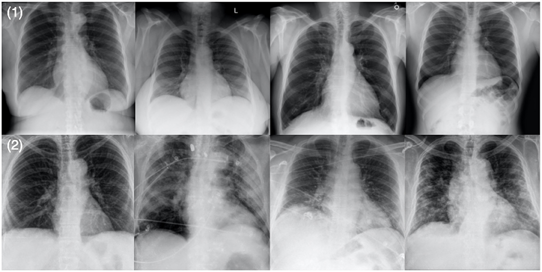 Original figure from On the Trade-off Between Privacy Protection and Data Utility for Chest X-ray Images